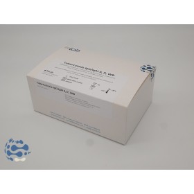 Tuberculose IgG/IgM cassette (20 tests) S, P, WB