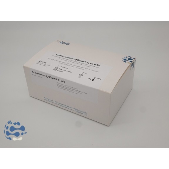 Tuberculose IgG/IgM cassette (20 tests) S, P, WB