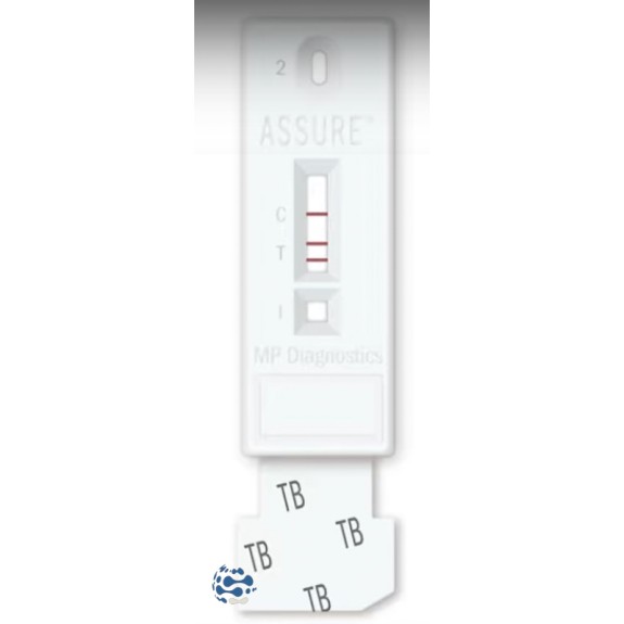 MP Biomedical ASSURE TB (20 tests)